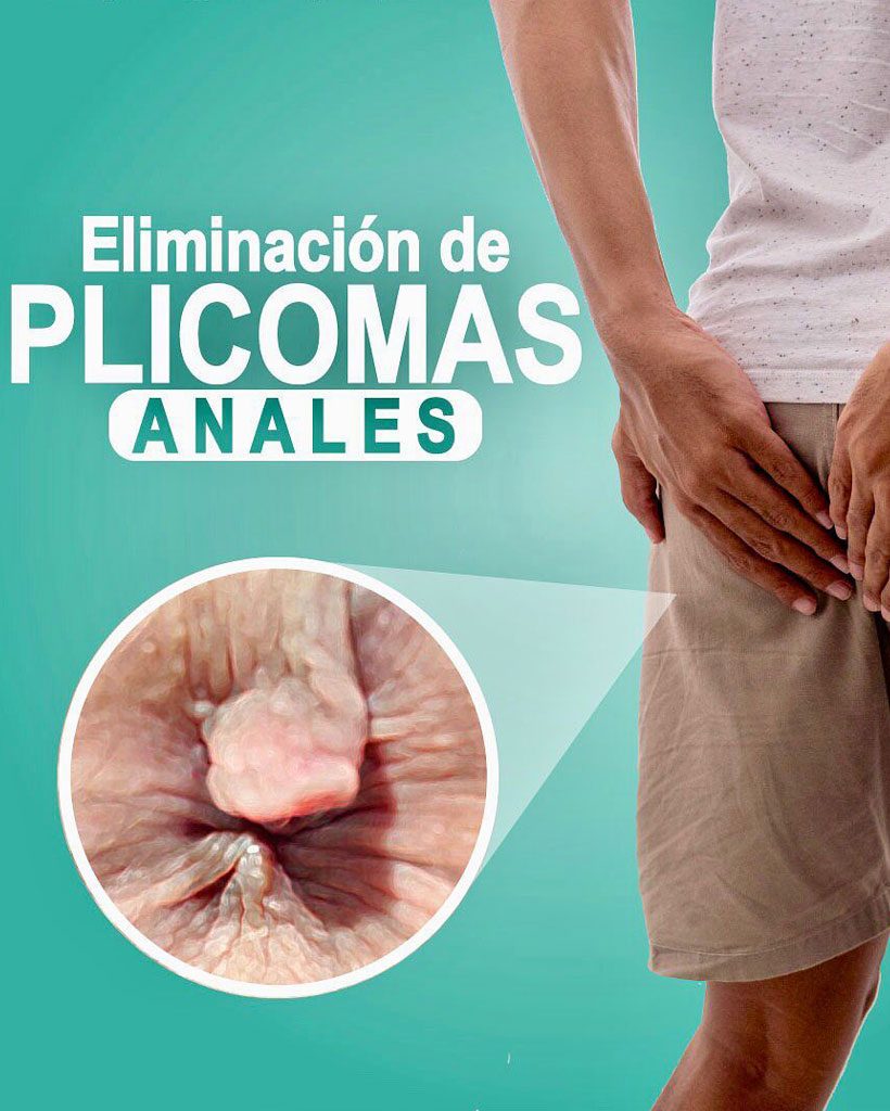 plicoma